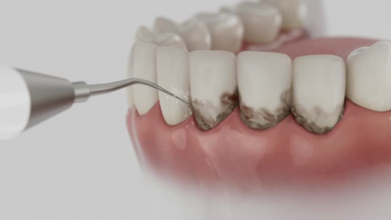 Trusted Teeth Cleaning And Checkup service in Gloucester Point, VA - Dentist Open Now